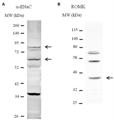 The Angiotensin II Type 1 Receptor-Associated Protein Attenuates Angiotensin II-Mediated Inhibition of the Renal Outer Medullary Potassium Channel in Collecting Duct Cells